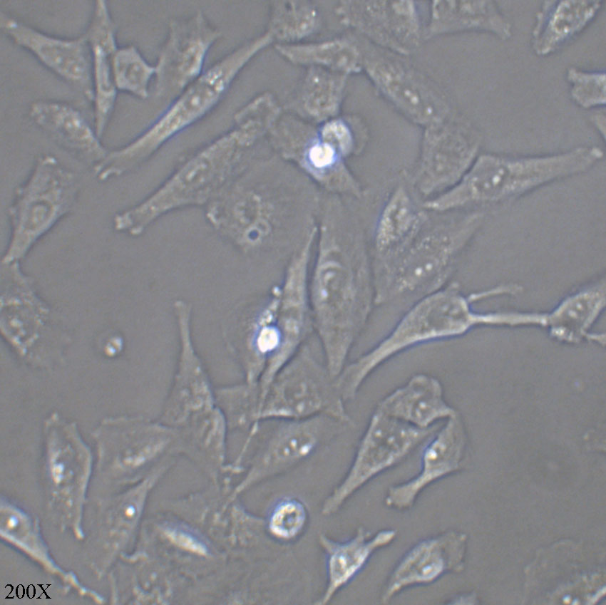 SNU-449 人肝癌细胞