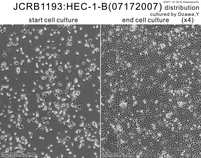 HEC-1-B 人子宫内膜腺癌细胞