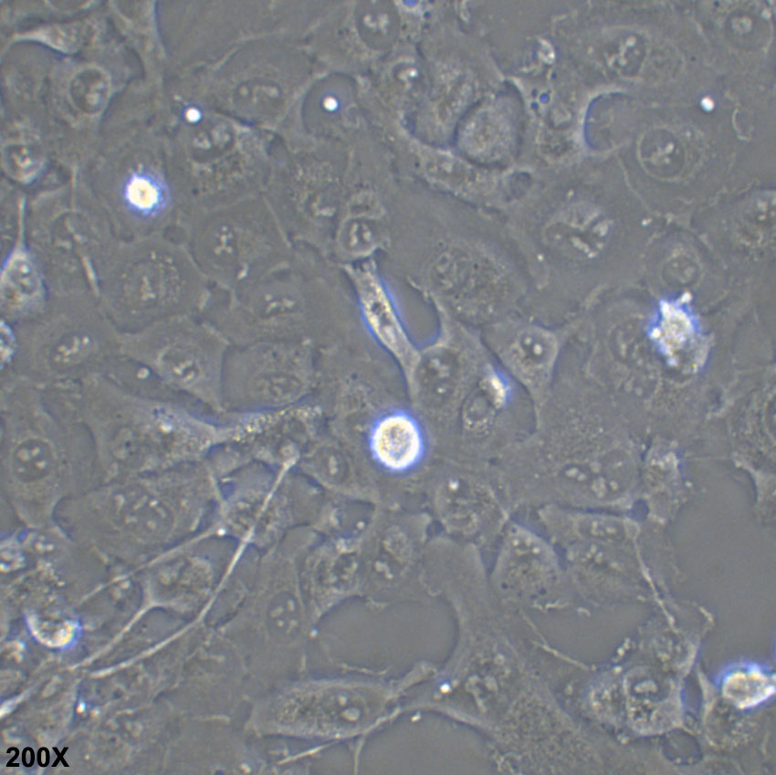HT-1080 人纤维肉瘤细胞