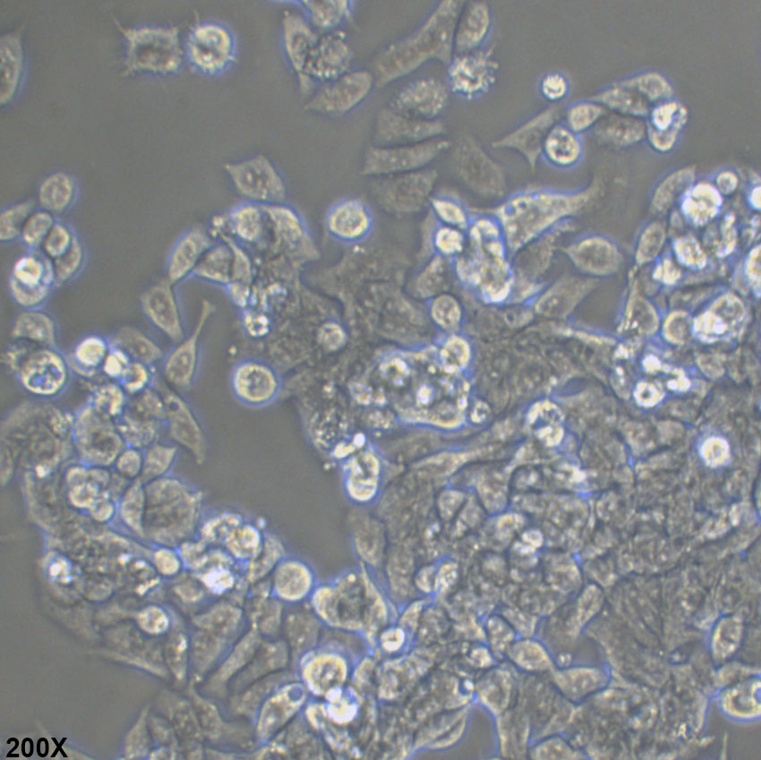 LS 174T 人结肠腺癌细胞