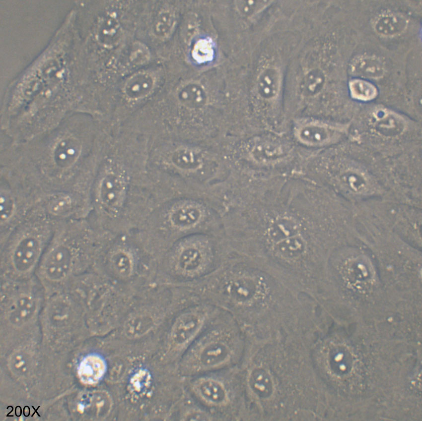 SNU-182 人肝癌细胞