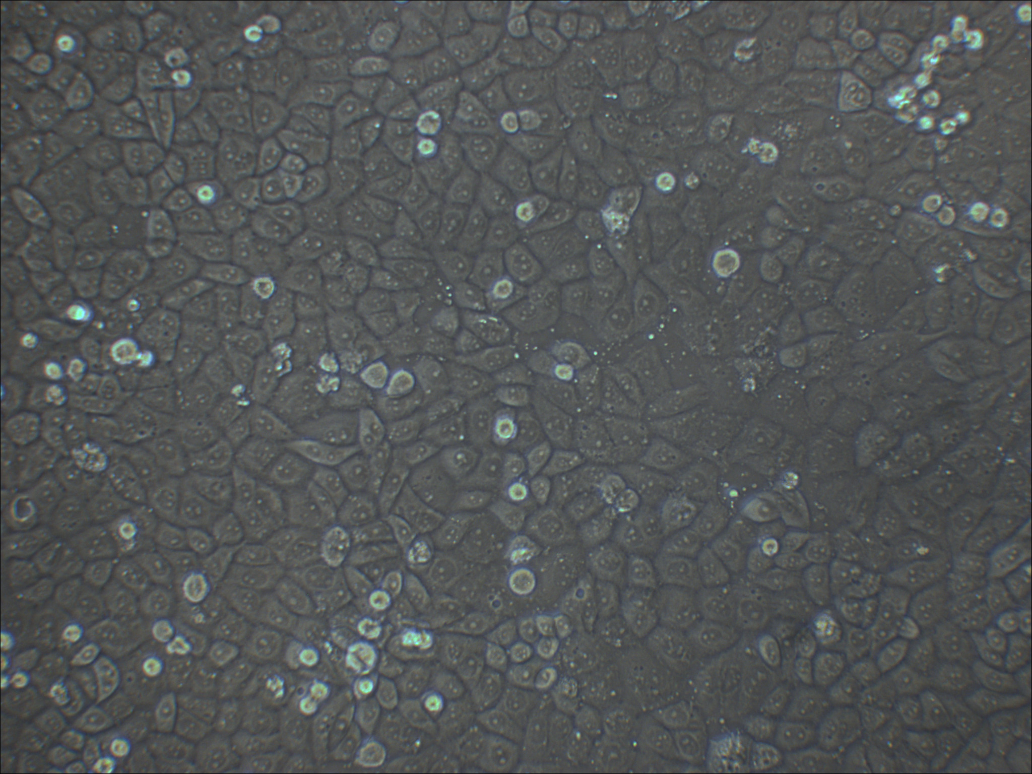 MDA-MB-468 人乳腺癌细胞