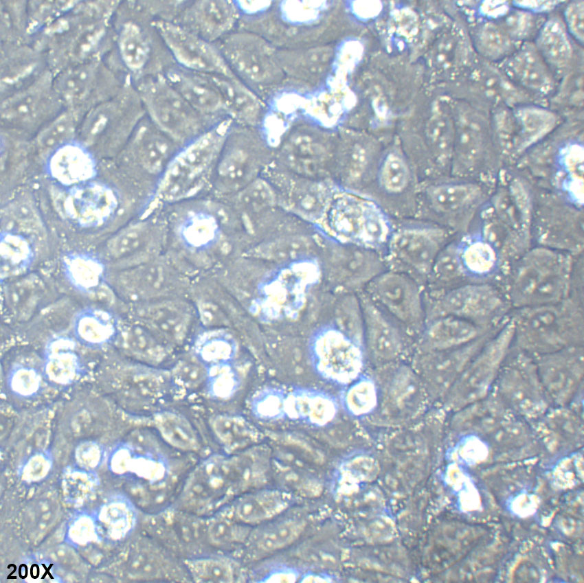 A-375 人恶性黑色素瘤细胞