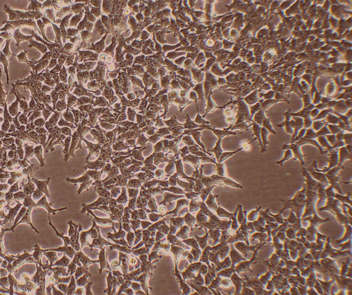 293T SV40T转化的人胚肾细胞