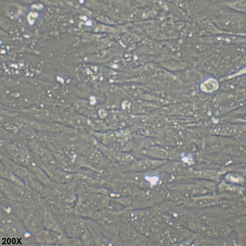 hFOB 1.19 SV40转染人成骨细胞