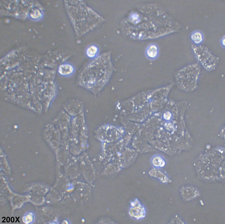 A-673 人横纹肌肉瘤细胞