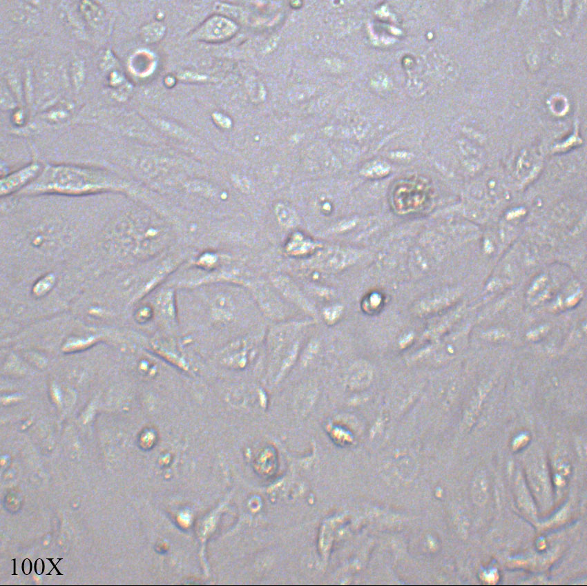 ACHN 人肾细胞腺癌细胞