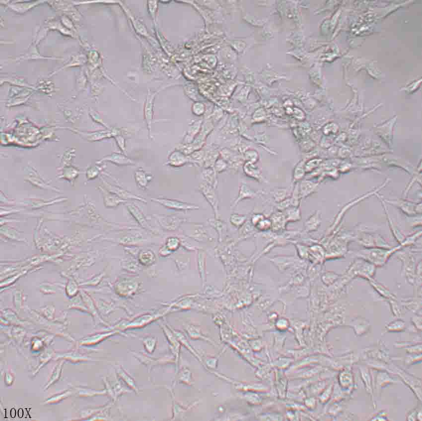 RD 人恶性胚胎横纹肌肉瘤细胞