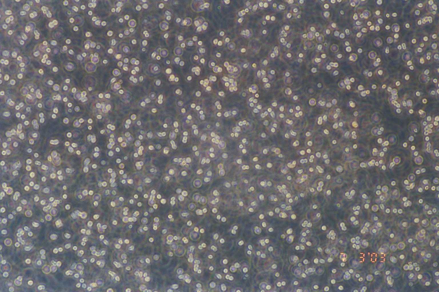 RAMOS(RA.1) 人B淋巴细胞瘤细胞