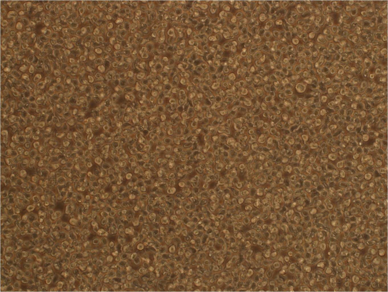 JeKo-1 人套细胞淋巴瘤细胞