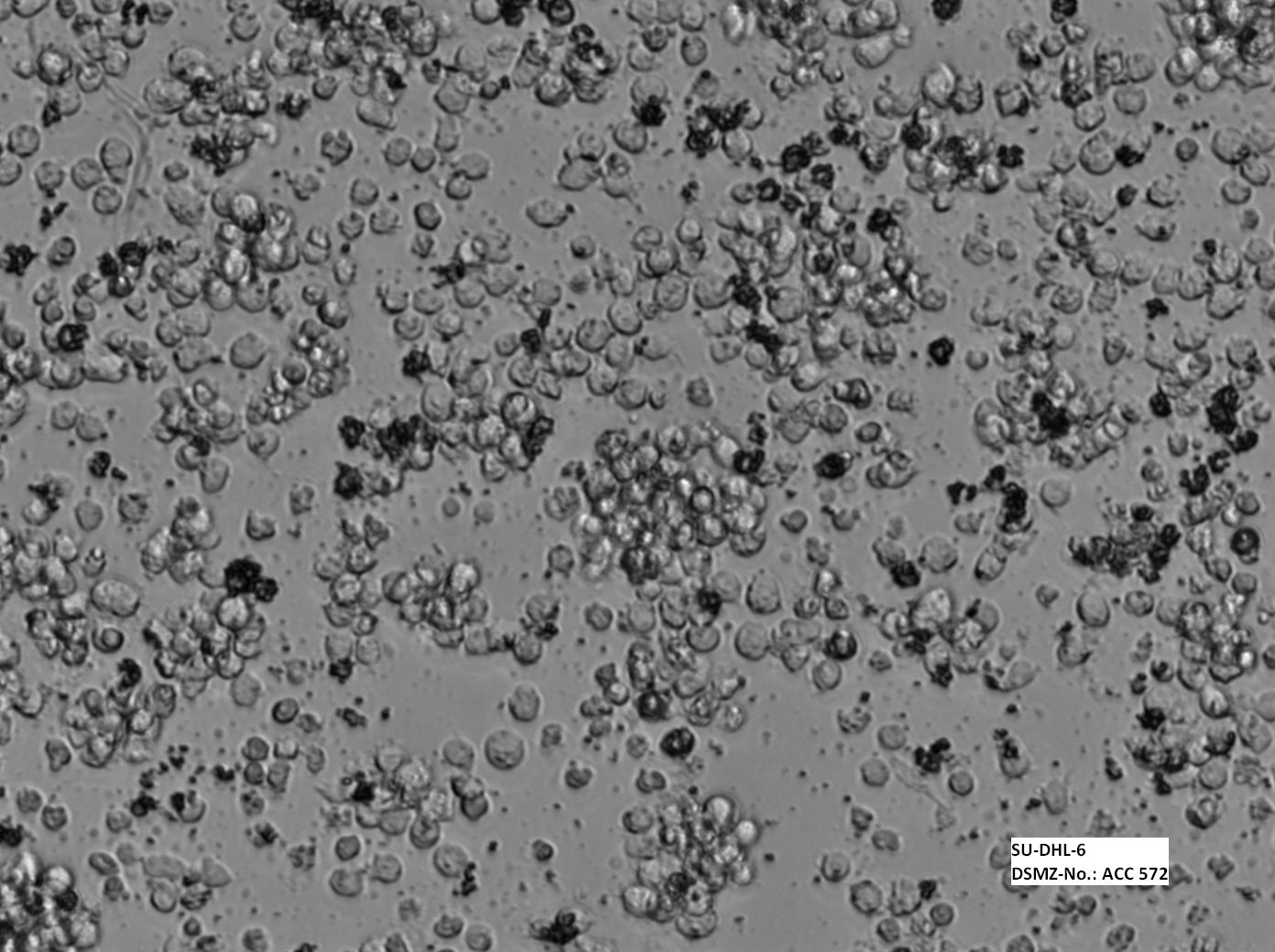 Su-DHL-6 人B细胞淋巴瘤细胞