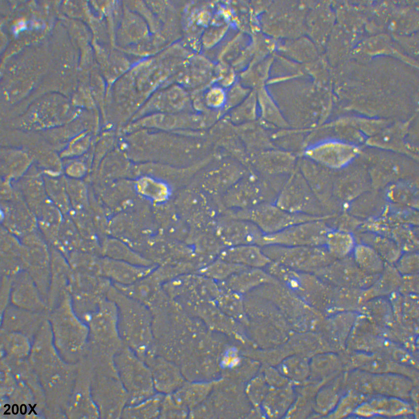 NCI-H2009 人肺腺癌细胞