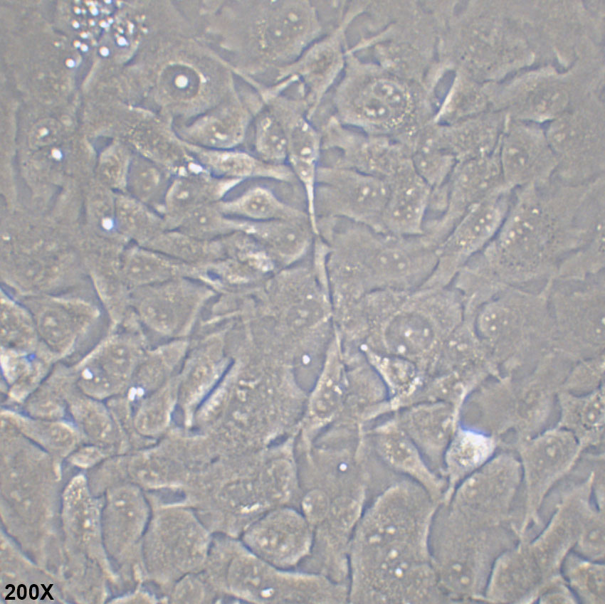 Calu-1 人肺癌细胞