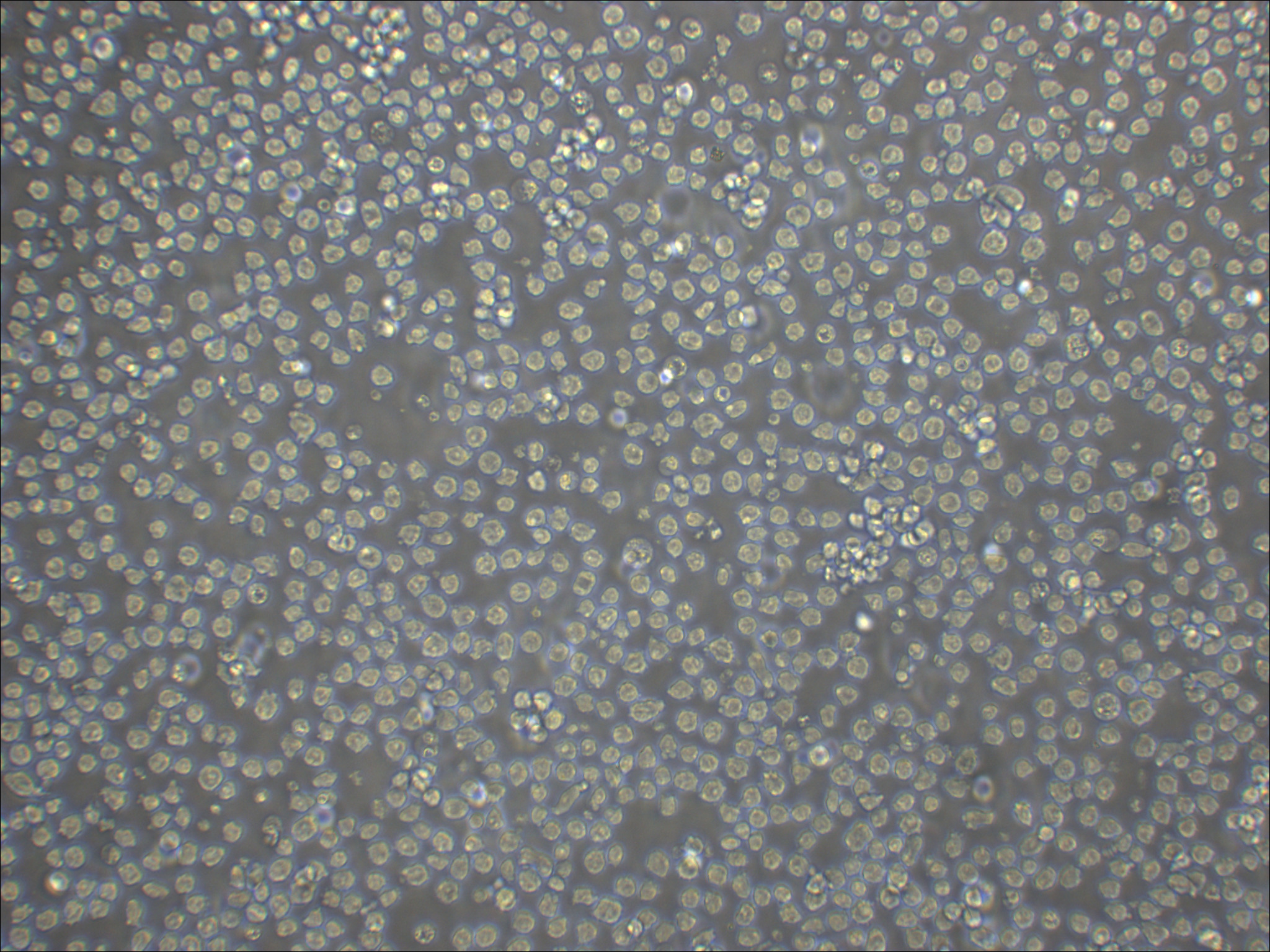NALM6 B系急性淋巴细胞白血病细胞