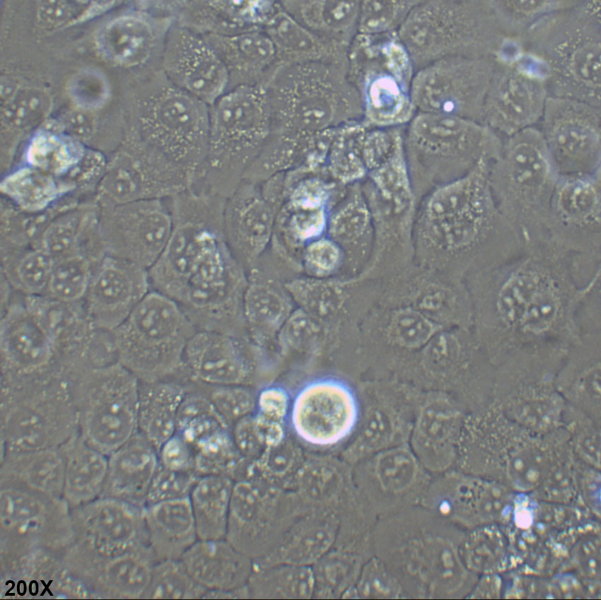 Kyse-150 人食管鳞癌细胞