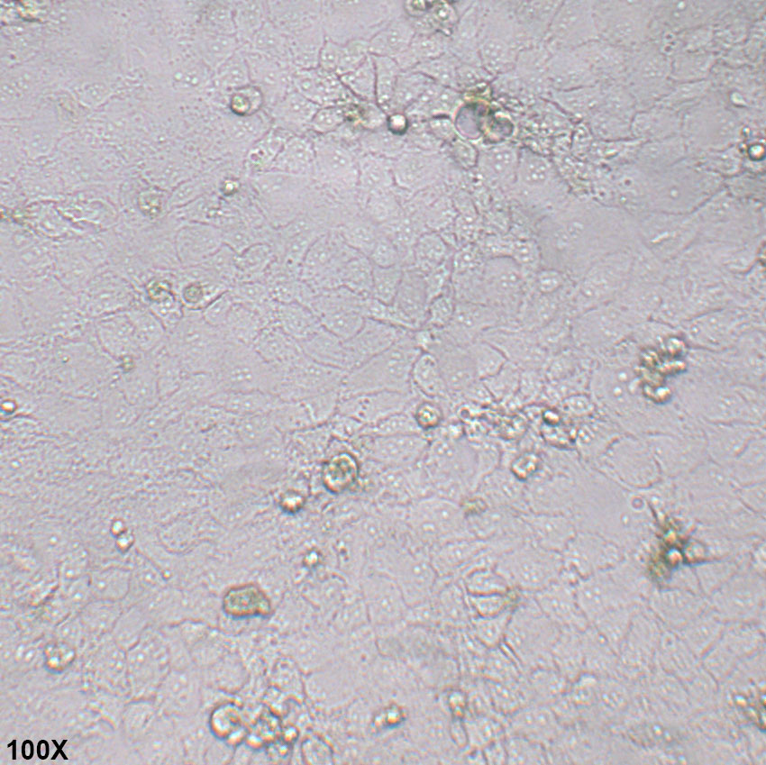 PLC/PRF/5 人肝癌亚力山大细胞