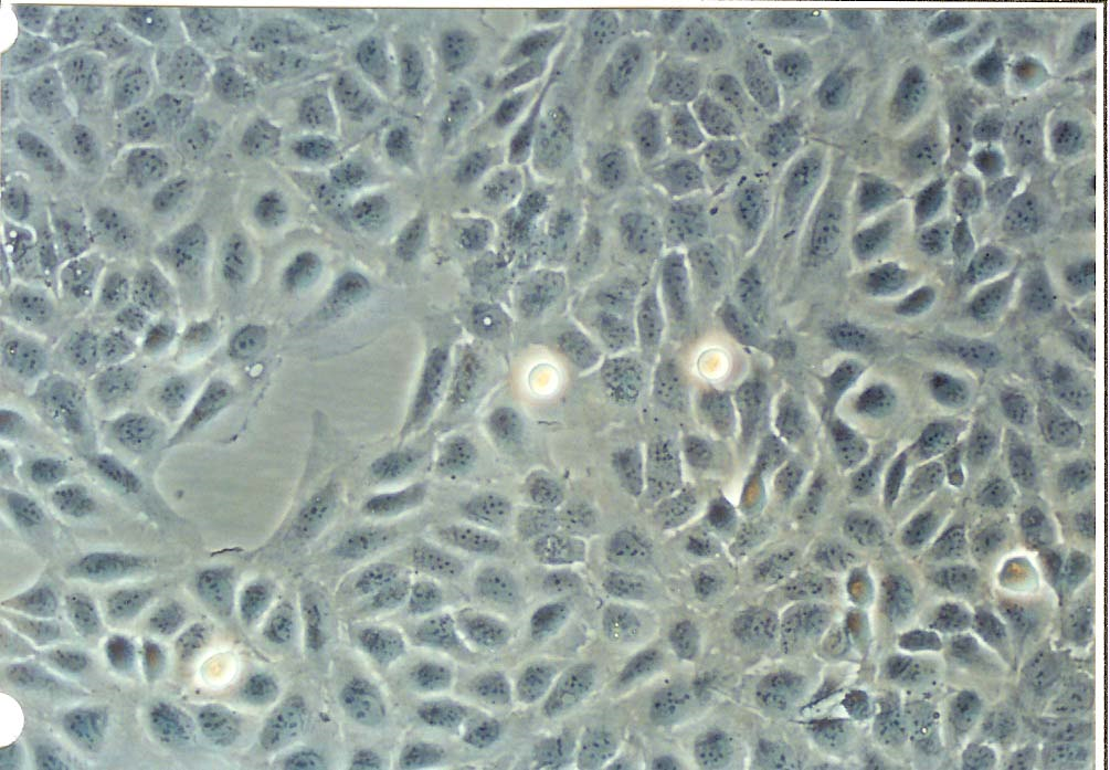 U-2 OS 人骨肉瘤细胞