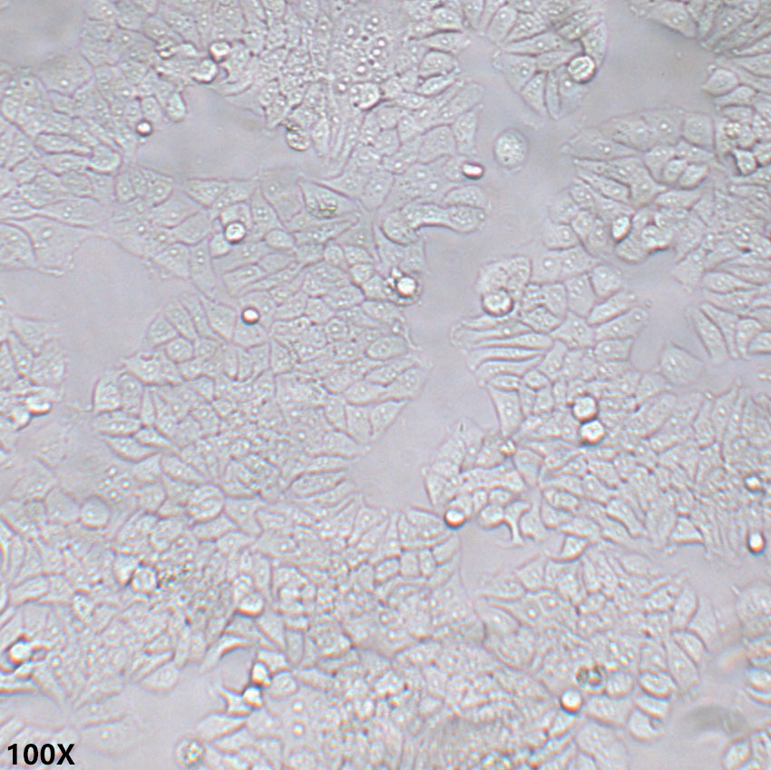 T47D 人乳腺导管癌细胞