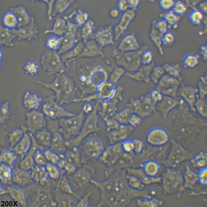 DMS 114 人小细胞肺癌细胞