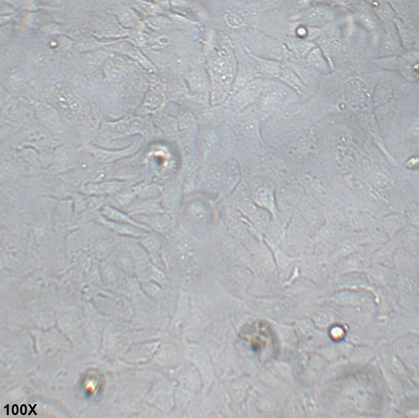 SK-OV-3 人卵巢腺癌细胞