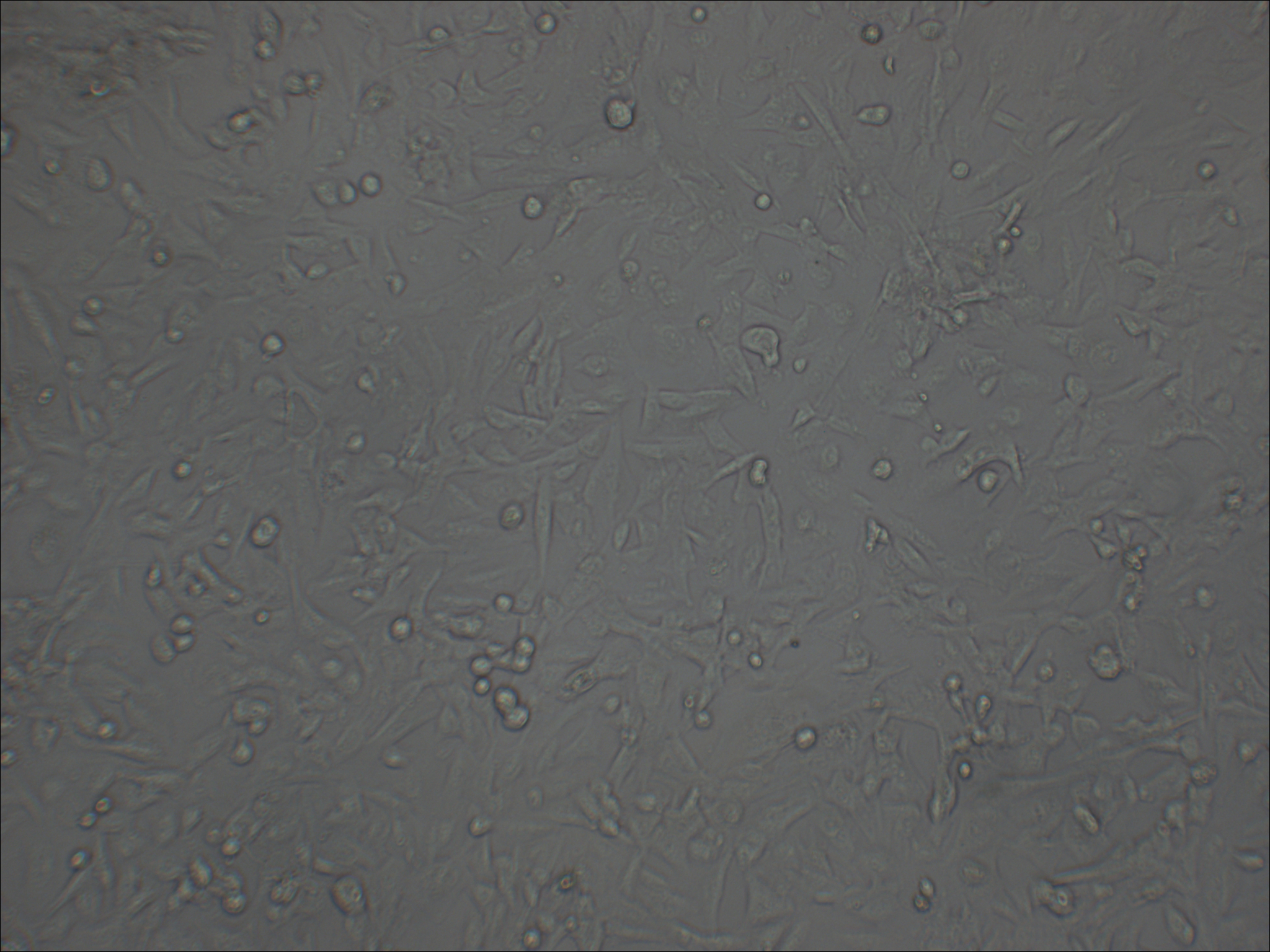 NCI-H1975 人非小细胞肺腺癌细胞