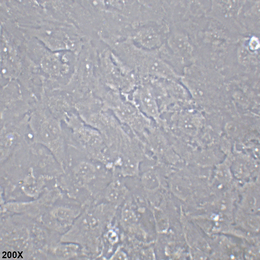 TCCSUP 人膀胱癌细胞
