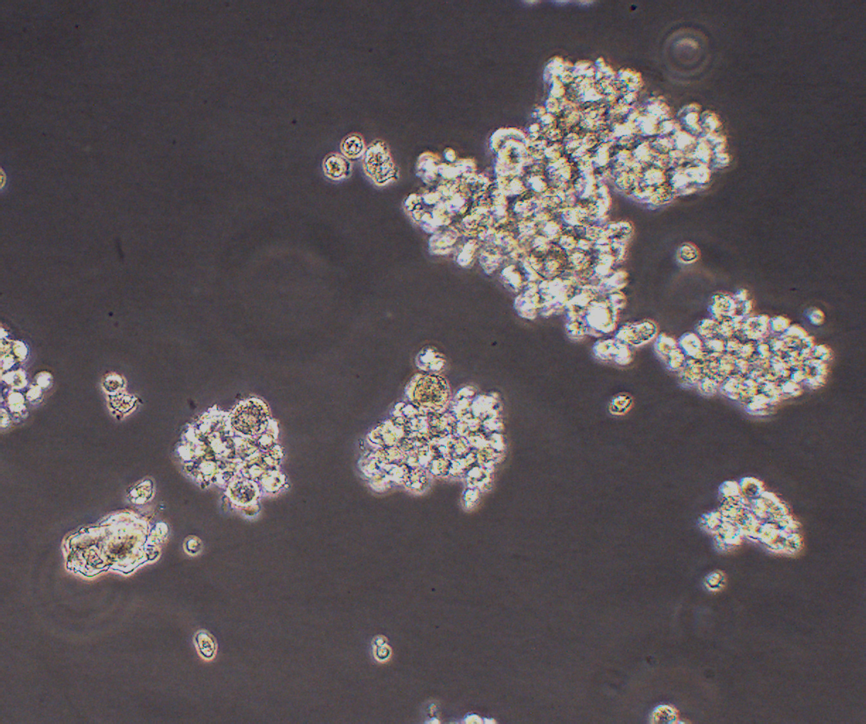 LP-1 人多发性骨髓瘤细胞