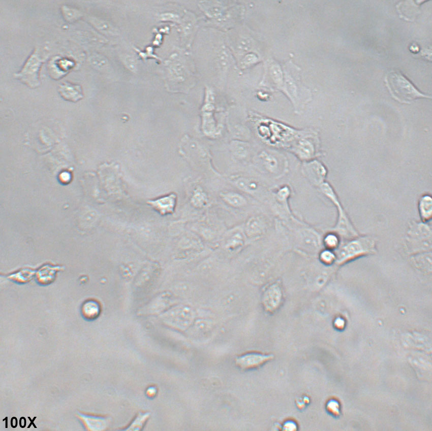 Caov-3 人卵巢癌细胞