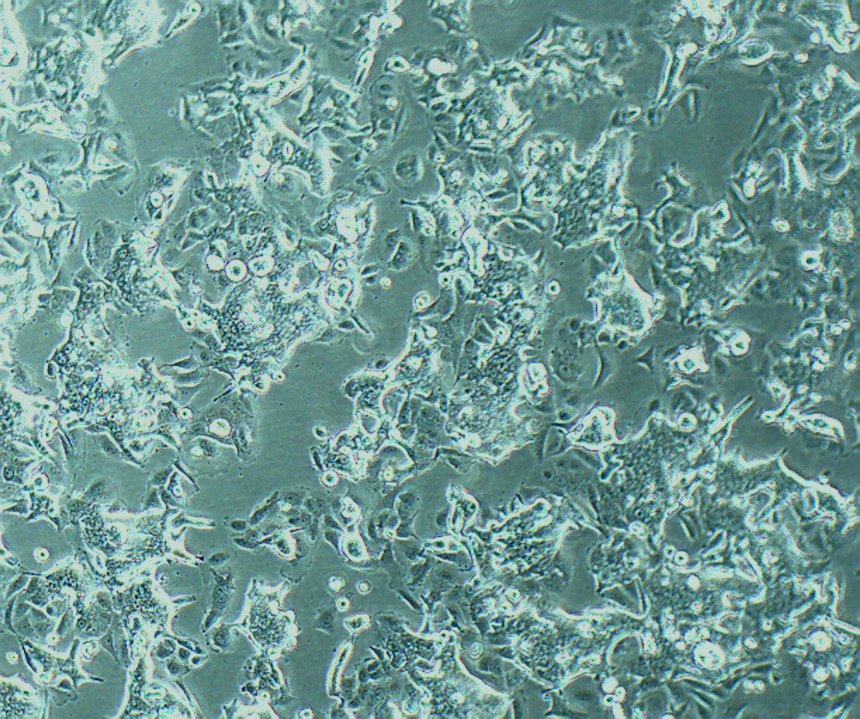 SW480 人结肠腺癌细胞