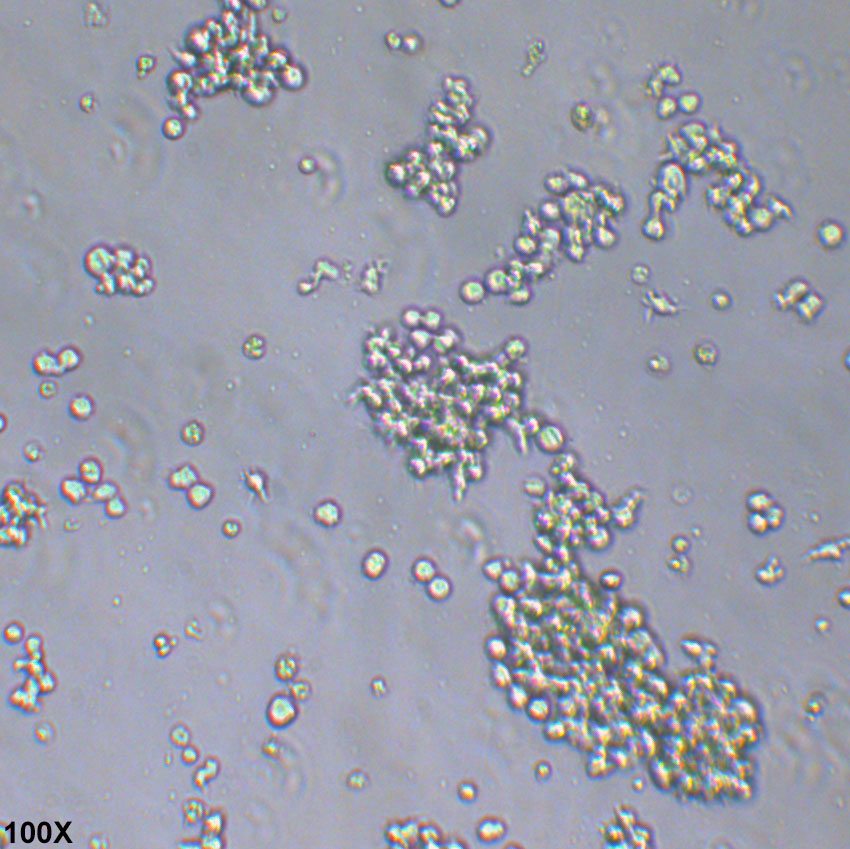 HuT 78 人T淋巴细胞白血病细胞