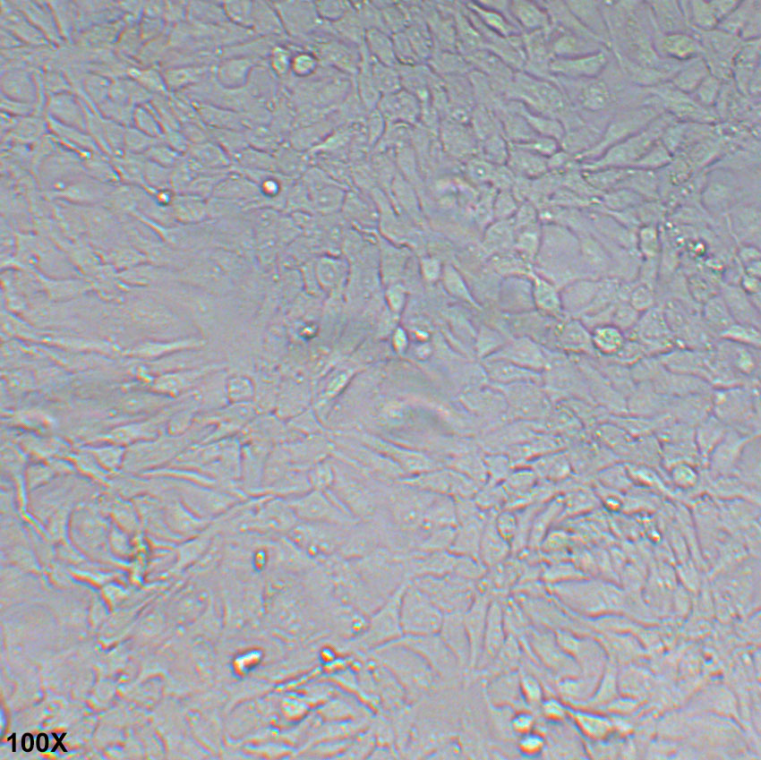 NCI-H2009 人肺腺癌细胞