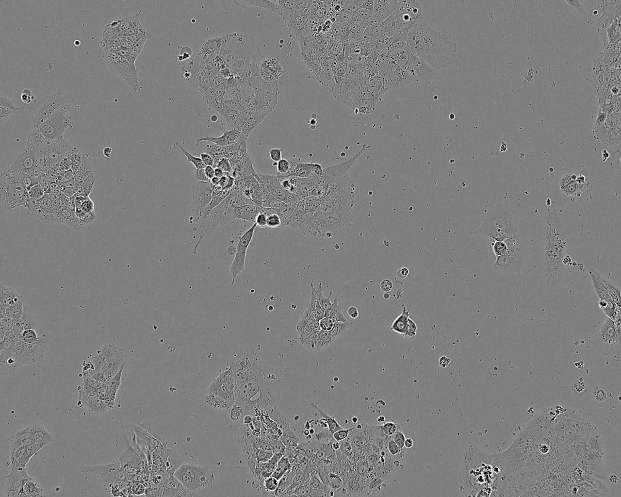 BeWo 人胎盘绒膜癌细胞