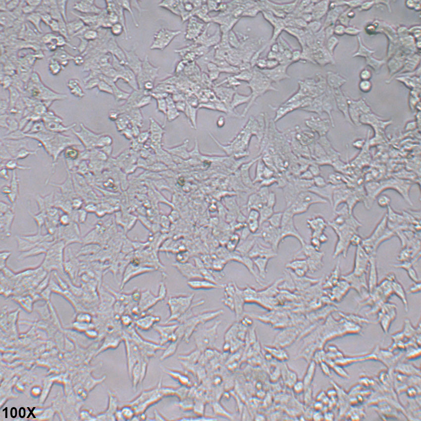 22Rv1 人前列腺癌细胞