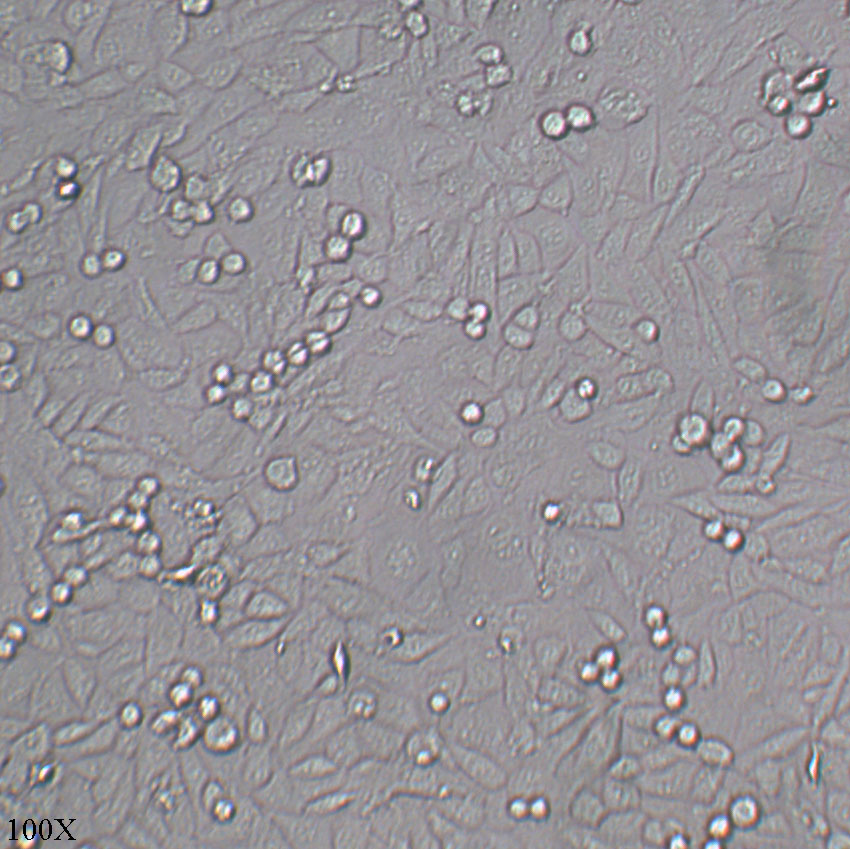 T24 人膀胱移行细胞癌细胞