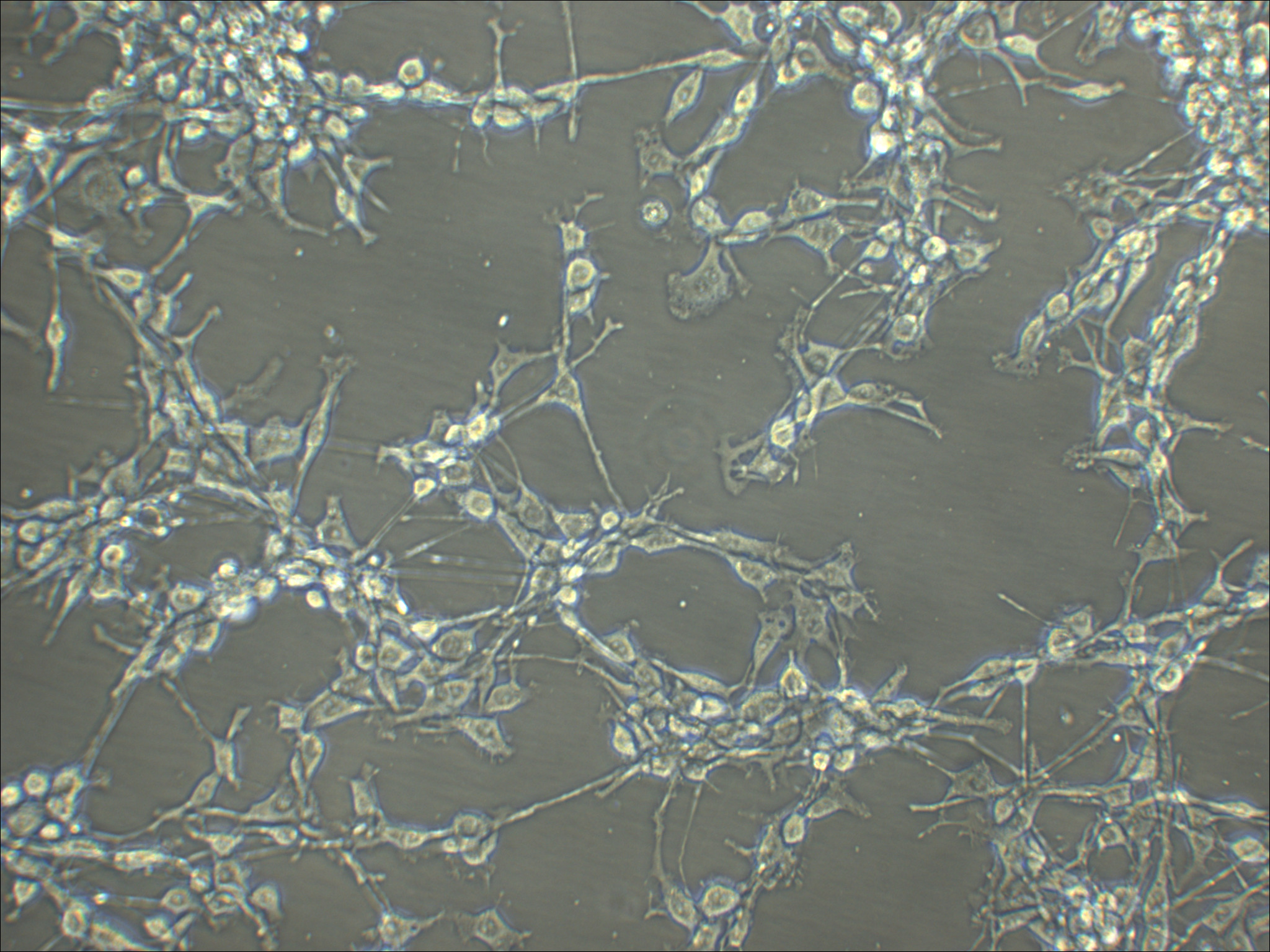 MFC 小鼠前胃癌细胞