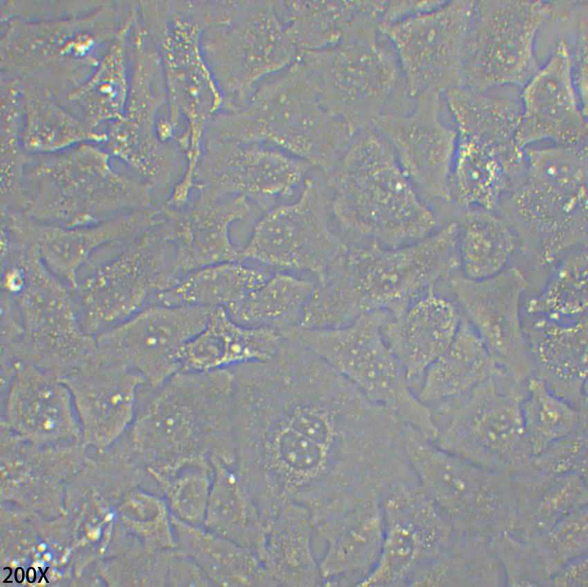 Kyse-520 人食管鳞癌细胞