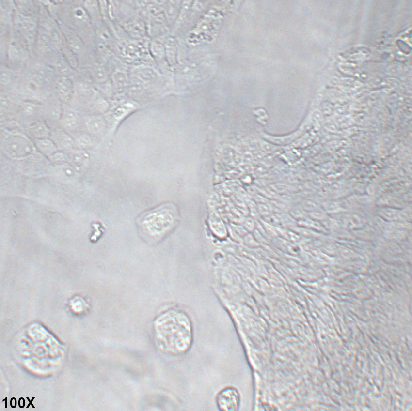SW1116 人结肠腺癌细胞