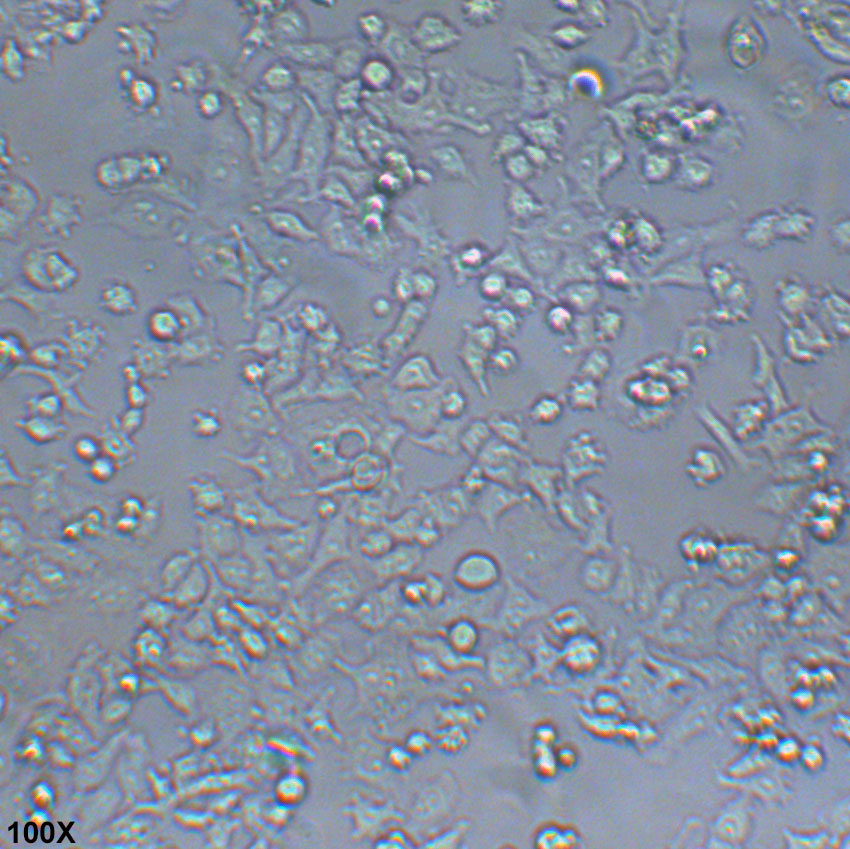 DMS 114 人小细胞肺癌细胞