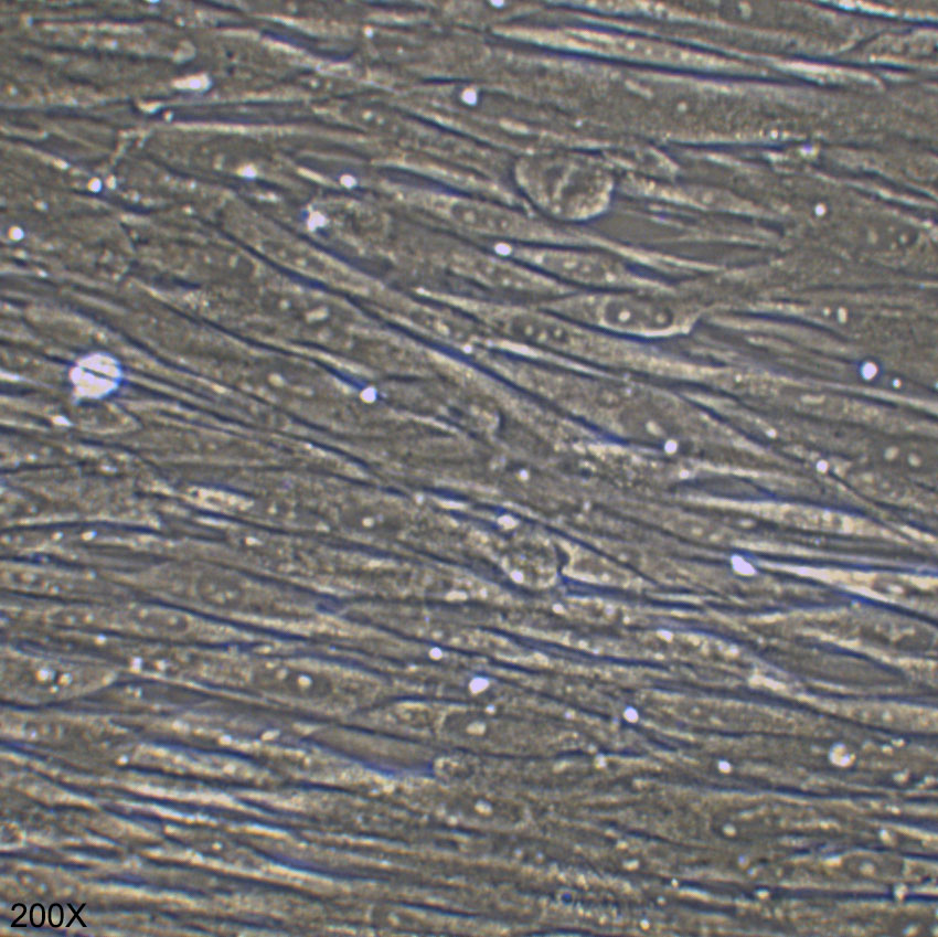 MRC-5 人胚肺细胞