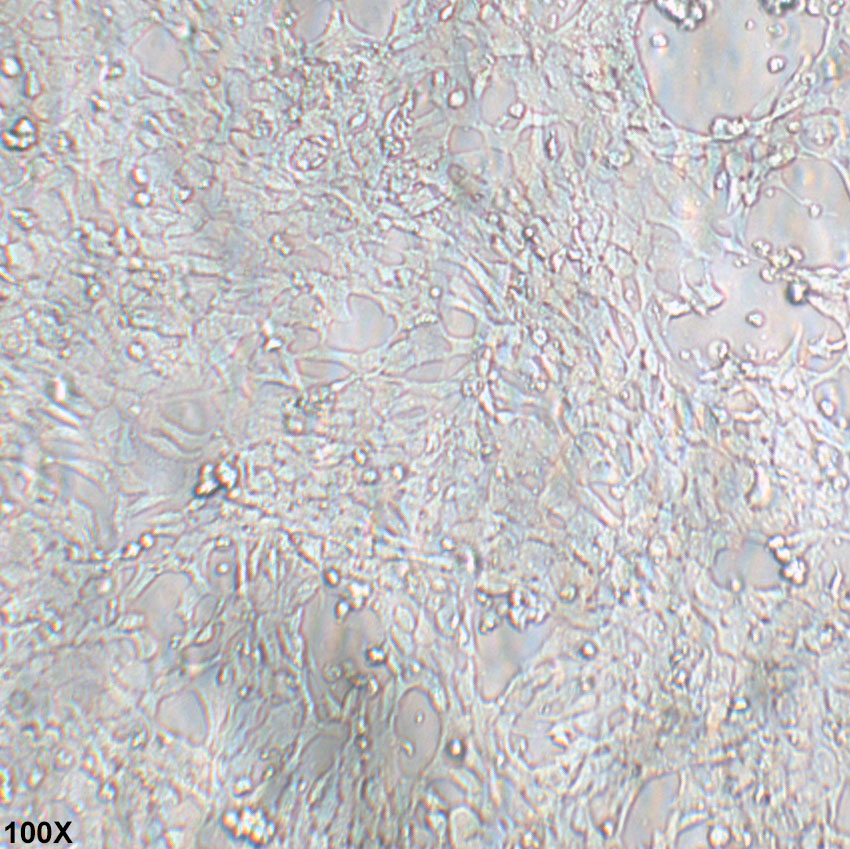 SK-N-MC 人神经上皮瘤细胞
