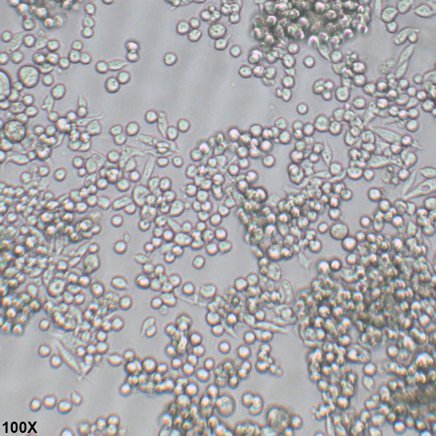 MKN45 人胃癌细胞