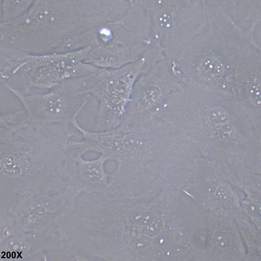 SNU-423 人肝癌细胞