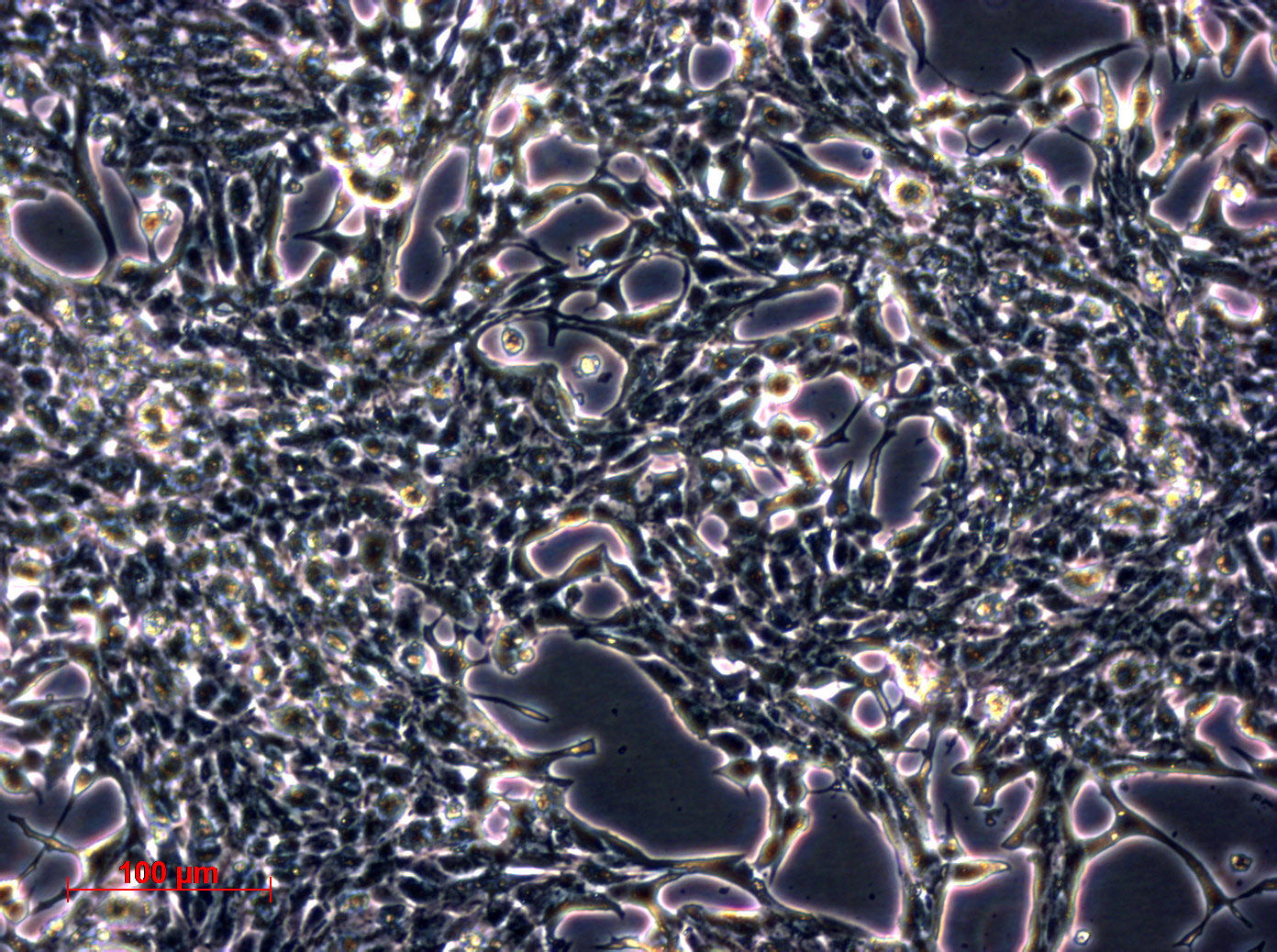 TT 人甲状腺导管癌细胞（髓样癌）