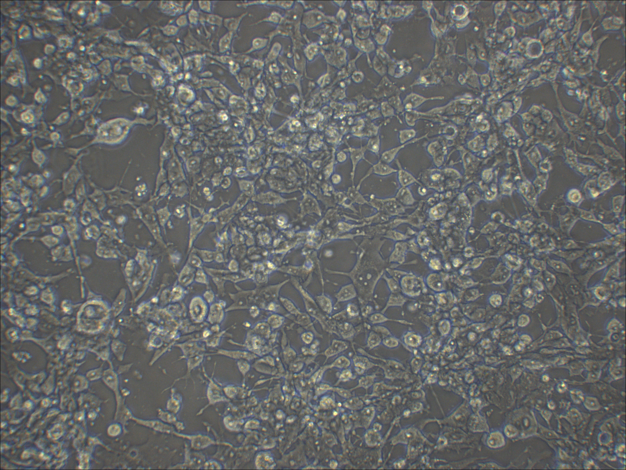 HePa1-6 小鼠肝癌细胞