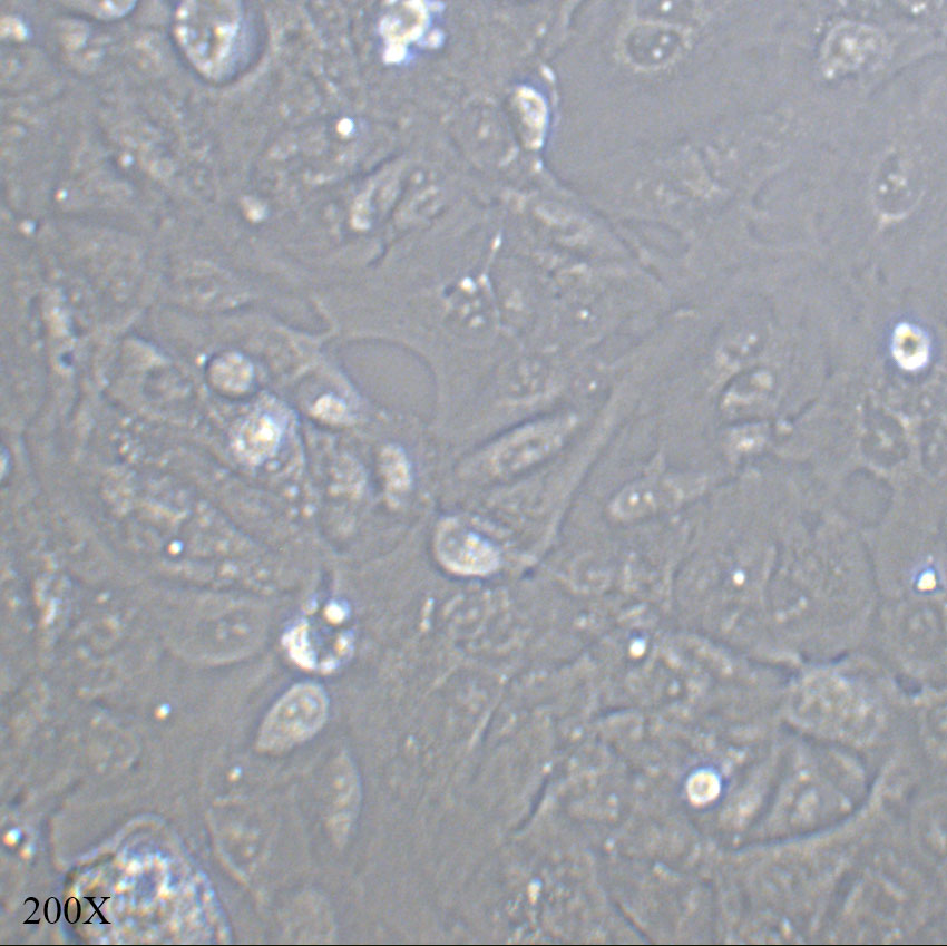 ACHN 人肾细胞腺癌细胞