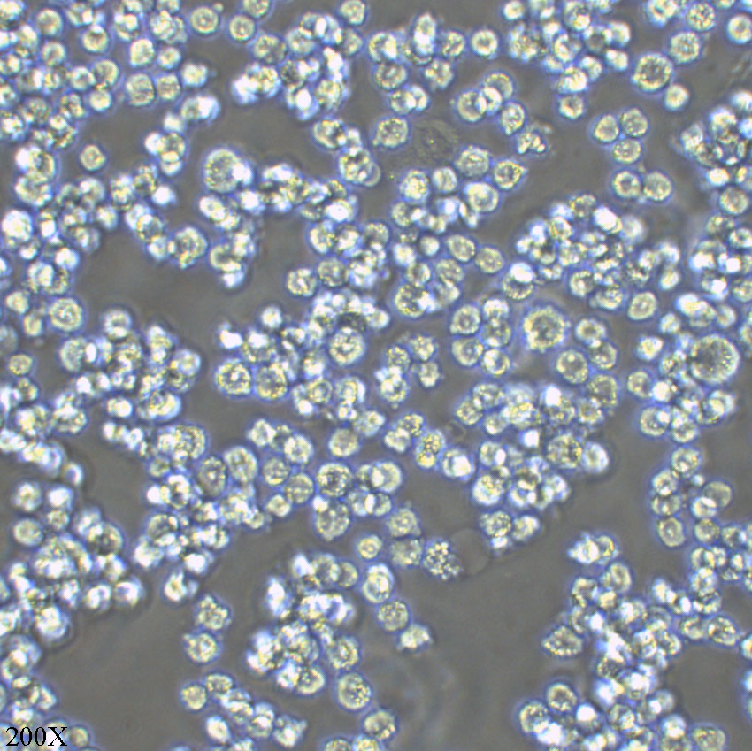 Namalwa 人Burkitt's淋巴瘤细胞