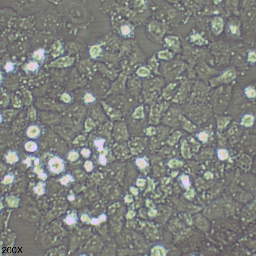 NCI-H23 人非小细胞肺癌细胞
