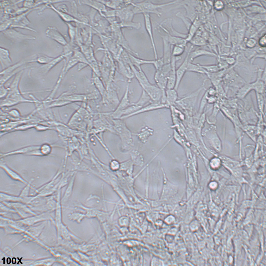 MOG-G-UVW 人脑星形胶质细胞瘤细胞