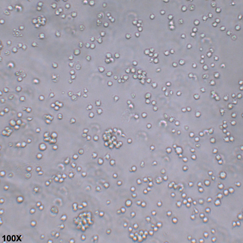Jurkat E6-1 人急性T淋巴细胞白血病细胞