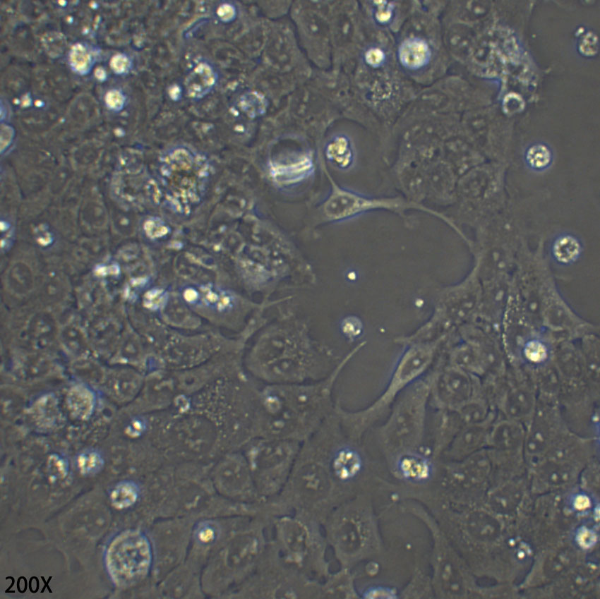 NCI-H1573 人非小细胞肺腺癌细胞
